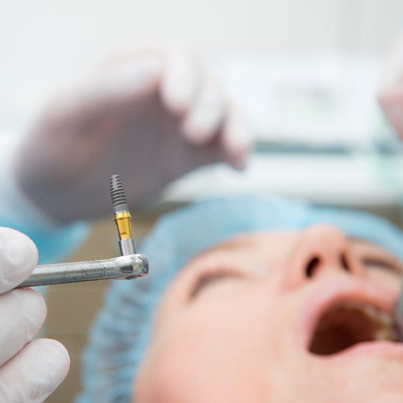 Closeup of dental implant about to be placed in patient’s mouth